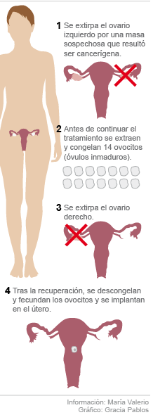 GraficoGraciaPablos